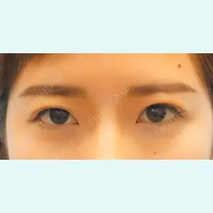 麹町皮ふ科・形成外科クリニックの症例