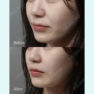 L‘amour clinic Tokyo【ラムールクリニック東京】の症例