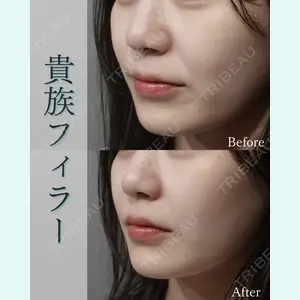 L‘amour clinic Tokyo【ラムールクリニック東京】の症例