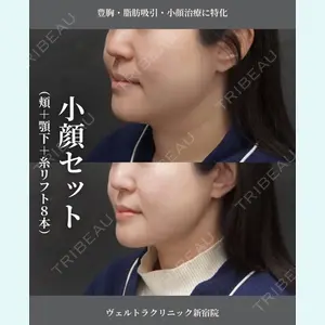 ヴェルトラクリニック 大阪院 西村 秀典医師の症例