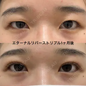 エターナル美容クリニック 久門田 詳医師の症例
