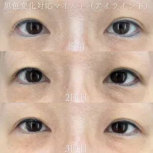 ziz CLINIC 村岡 史子医師の症例