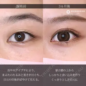 東京形成美容外科 船橋院 弓削田　浩主医師の症例