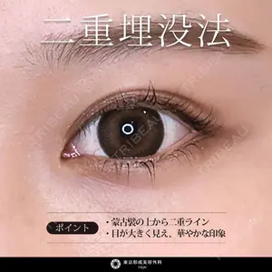 東京形成美容外科 船橋院 弓削田　浩主医師の症例