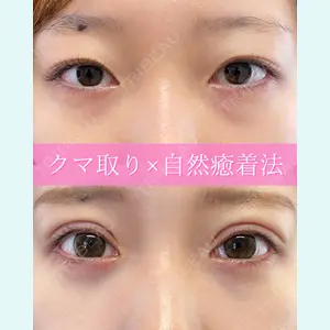ルラ美容クリニック 大阪本院 平田 一記医師の症例