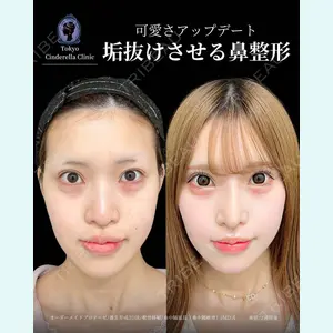 東京シンデレラ美容外科 新宿院 吉原 伯医師の症例