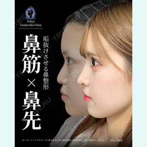 東京シンデレラ美容外科 新宿院 吉原 伯医師の症例