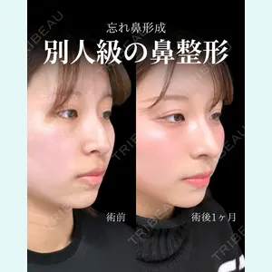 東京シンデレラ美容外科 池袋院 石井 達也医師の症例