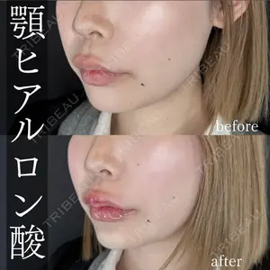 ルラ美容クリニック 大阪心斎橋院の症例