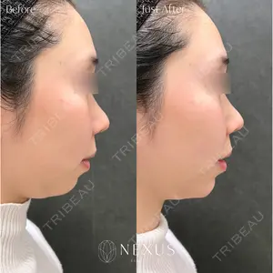 NEXUS CLINIC 岩井 勝矢医師の症例