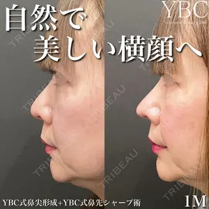 YBC横浜美容外科 大宮院 磯村 亮輔医師の症例