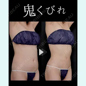 症例