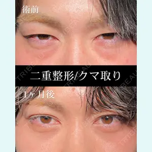 HAAB BEAUTY CLINIC 名古屋院 丸山 舜大医師の症例
