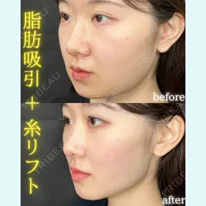 THE FIRST CLINIC 町田院 木暮 啓一郎医師の症例