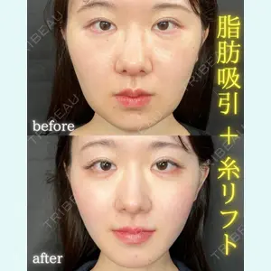 THE FIRST CLINIC 町田院 木暮 啓一郎医師の症例