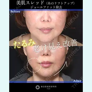 東京形成美容外科 船橋院 山崎 修吾医師の症例