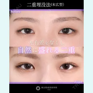 症例