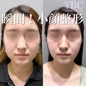 YBC横浜美容外科 大宮院 磯村 亮輔医師の症例