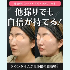 湘南美容クリニック 川崎院 伊藤 賀敏医師の症例