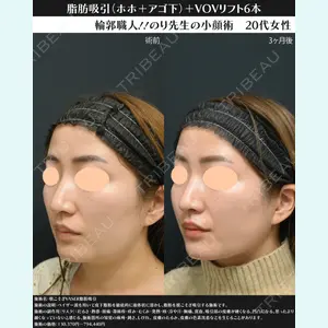 湘南美容クリニック 川崎院 伊藤 賀敏医師の症例