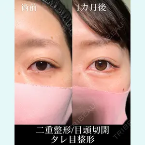 症例