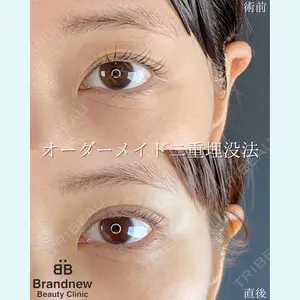 Brandnew Beauty Clinic 平山 容成医師の症例
