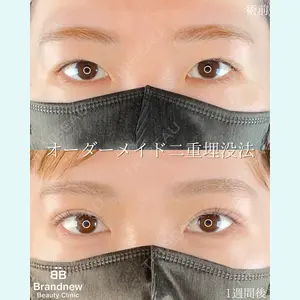 Brandnew Beauty Clinicの症例