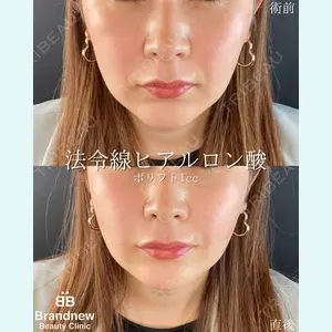 Brandnew Beauty Clinic 平山 容成医師の症例