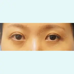 麹町皮ふ科・形成外科クリニックの症例