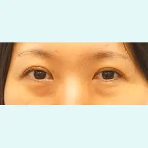 麹町皮ふ科・形成外科クリニックの症例