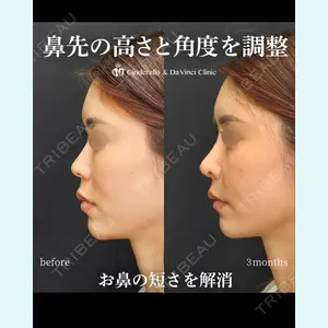 シンデレラ＆ダヴィンチクリニック 宮田 洋佑医師の症例