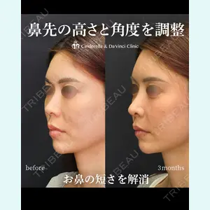 シンデレラ＆ダヴィンチクリニック 宮田 洋佑医師の症例