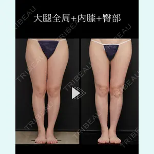 症例