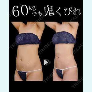 症例