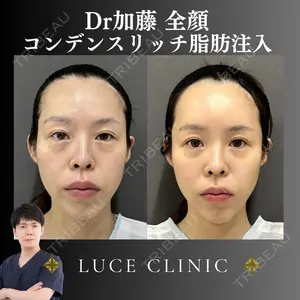 ルーチェクリニック 銀座院 加藤晴之輔医師の症例