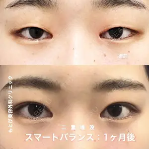 もとび美容外科クリニック 新宿院 西尾 浩二郎医師の症例
