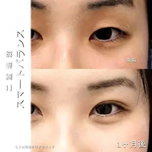 もとび美容外科クリニック 新宿院 西尾 浩二郎医師の症例