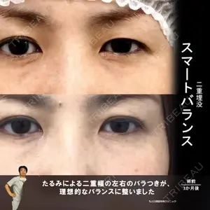 もとび美容外科クリニック 新宿院 西尾 浩二郎医師の症例