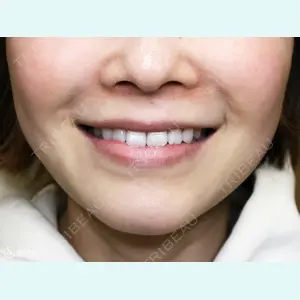 聖心美容クリニック 札幌院 前多 一彦医師の症例