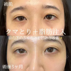 症例