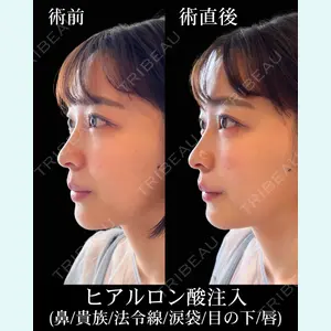 HAAB×DREAM BEAUTY CLINIC 東京本院 佐野 圭医師の症例