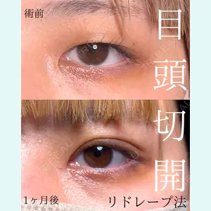 症例