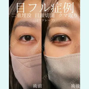 症例