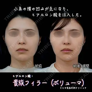 もとび美容外科クリニック 新宿院 西尾 浩二郎医師の症例