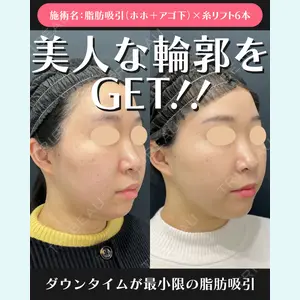 湘南美容クリニック 川崎院 伊藤 賀敏医師の症例