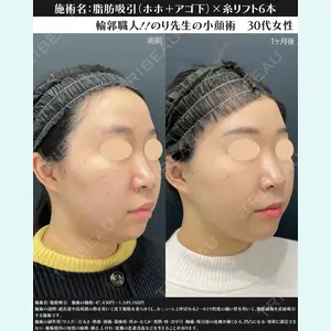 湘南美容クリニック 川崎院 伊藤 賀敏医師の症例