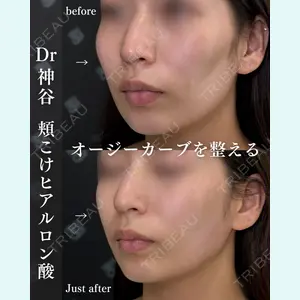 EMMO FACE CLINIC 大阪梅田院 神谷 一成医師の症例