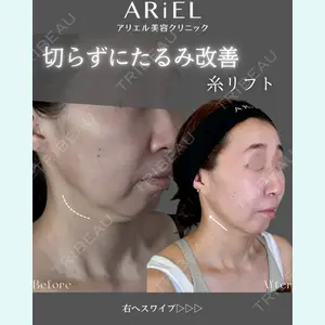 アリエル美容クリニック 郡山院 安齋 誠基医師の症例