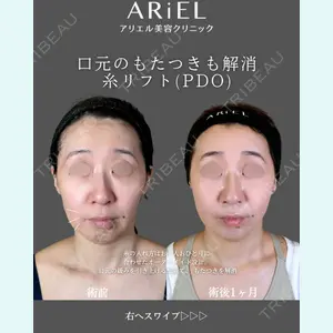 アリエル美容クリニック 郡山院 安齋 誠基医師の症例