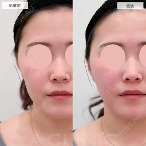 A CLINIC（エークリニック） 福岡院 小林 直樹医師の症例